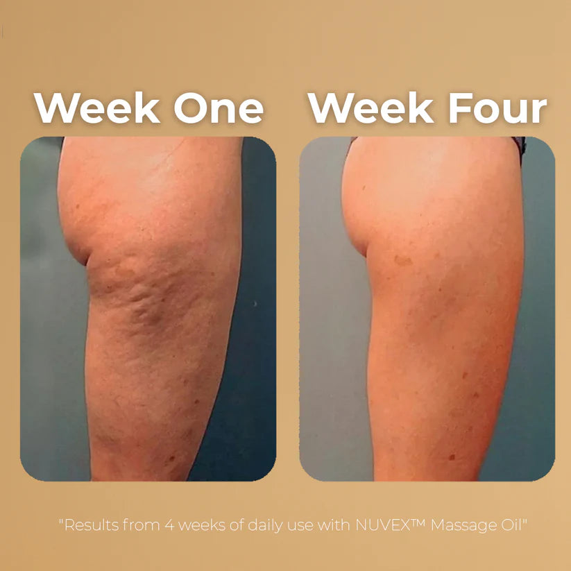 Anti-Cellulite Massage Oil